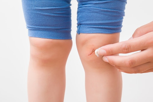Kenali berbagai jenis bekas luka pada kulit