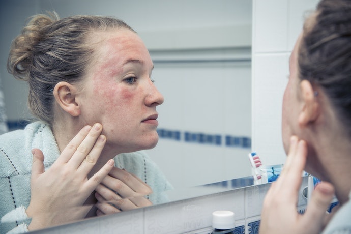 Untuk menenangkan kulit sensitif, krim wajah dengan kandungan seminimal mungkin