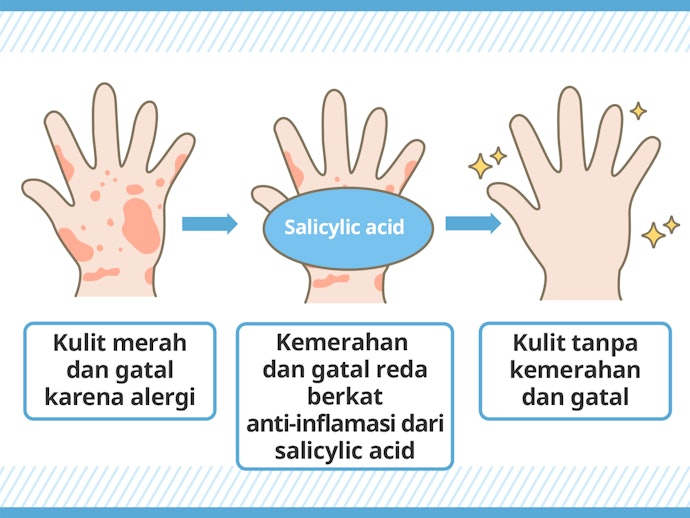 Salicylic acid, redakan gatal akibat alergi