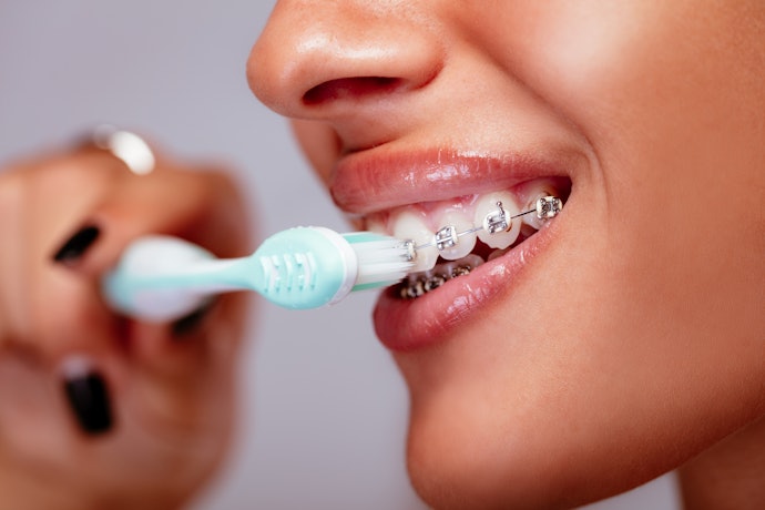 Produk yang membersihkan mulut secara optimal untuk pengguna kawat gigi