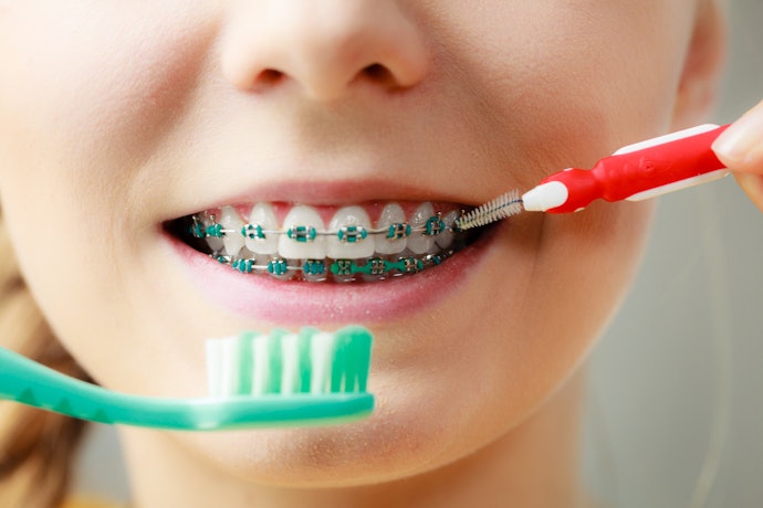 Sikat gigi khusus behel, mampu membersihkan hingga celah tak terjangkau