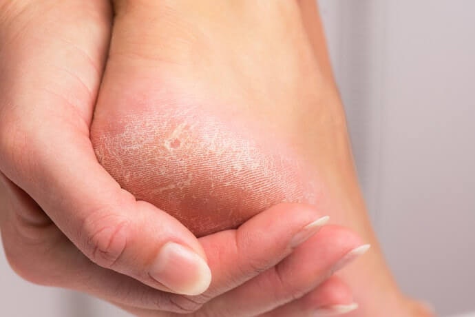 Dead Sea salt, dapat digunakan untuk exfoliating agar kulit tetap cantik