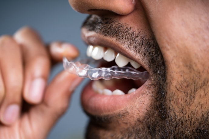 Teeth grinding: Pastikan mouthguard memang dibuat khusus
